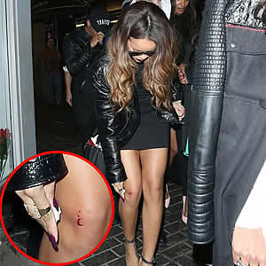 Rihanna Attacked by Fan Angry Over Chris Brown Reunion