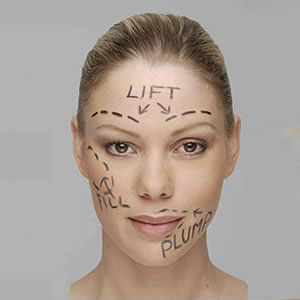 Cosmetic Surgery the New Teen Trend